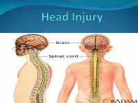 Head injury.pdf